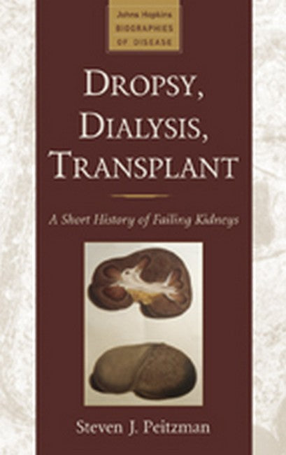 Dropsy, Dialysis, Transplant