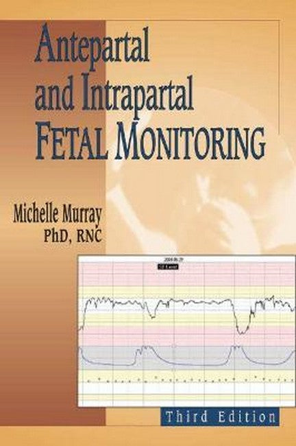 Antepartal and Intrapartal Fetal Monitoring 3/e