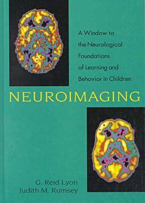 Neuroimaging