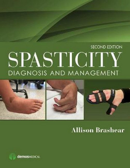 Spasticity 2/e